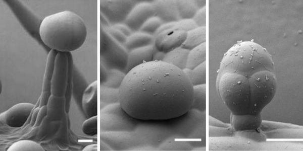 Microscopic view of the most common trichomes